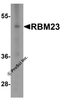 Western blot analysis of RBM23 in (A) human tonsil and (B) rat stomach tissue lysate with RBM23 antibody at 1 &#956;g/mL.