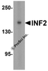 Western blot analysis of INF2 in (A) human tonsil and (B) rat stomach tissue lysate with INF2 antibody at 1 &#956;g/mL.