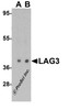 Western blot analysis of LAG3 in human liver tissue lysate with LAG3 antibody at (A) 1 and (B) 2 &#956;g/mL