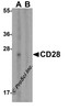 Western blot analysis of CD28 in human spleen tissue lysate with CD28 antibody at 1 &#956;g/mL in (A) the absence and (B) the presence of blocking peptide.