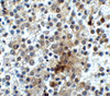 Immunohistochemistry of CD28 in human spleen tissue with CD28 antibody at 2 ug/ml.