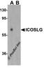 Western blot analysis of ICOSLG in human lymph node tissue lysate with ICOSLG antibody at 1 &#956;g/mL in (A) the absence and (B) the presence of blocking peptide.