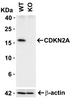 Figure 1 KO Validation of CDKN2A in 293 Cells 
Loading: 10 &#956;g of 293 WT cell lysates or CDKN2A KO cell lysates. Antibodies: CDKN2A, 8975 (2 &#956;g/mL) and beta-actin, 3779 (1 &#956;g/mL) , 1 h incubation at RT in 5% NFDM/TBST.
Secondary: Goat Anti-Rabbit IgG HRP conjugate at 1:10000 dilution.