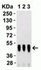 Figure 2 Western Blot Validation with SARS-CoV-2 (COVID-19) Nucleocapsid Recombinant ProteinLoading: 50 ng per lane of SARS-CoV-2 (COVID-19) Nucleocapsid recombinant protein. Antibodies: SARS-CoV-2 (COVID-19) Nucleocapsid, 9103, 1h incubation at RT in 5% NFDM/TBST. Secondary: Goat anti-rabbit IgG HRP conjugate at 1:10000 dilution. Lane 1: 0.5 ug/mL, Lane 2: 1 ug/mL and Lane 3: 2 ug/mL