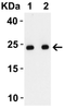 Figure 2 Western Blot Validation with SARS-CoV-2 Envelope Recombinant Protein
Loading: 50 ng per lane of SARS-CoV-2 Envelope recombinant protein (92-730) .
Antibodies: SARS-CoV-2 (COVID-19) Envelope, 9169, 1h incubation at RT in 5% NFDM/TBST.
Secondary: Goat anti-rabbit IgG HRP conjugate at 1:10000 dilution.
Lane 1: 1 ug/mL and 
Lane 2: 2 ug/mL