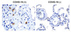 Figure 2 ELISA Validation 
Antibodies: SARS-CoV-2 (COVID-19) NSP14 (ExoN) Antibody, 9185. A direct ELISA was performed using immunogen peptide (9185P) as coating antigen and the anti-SARS-CoV-2 (COVID-19) NSP14 (ExoN) antibody as the capture antibody. Secondary: Goat anti-rabbit IgG HRP conjugate at 1:20000 dilution. Detection range is from 0.3 ng/mL to 1000ng/mL.