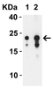 Figure 2 Western Blot Validation with SARS-CoV-2 (COVID-19) ORF3b Protein
Loading: 30 ng per lane of SARS-CoV-2 (COVID-19) ORF3b recombinant protein (10-005) .
Antibodies: SARS-CoV-2 (COVID-19) ORF3b, 9277, 1h incubation at RT in 5% NFDM/TBST.
Secondary: Goat anti-rabbit IgG HRP conjugate at 1:10000 dilution.
Lane 1: 0.1 ug/mL and 
Lane 2: 0.2 ug/mL