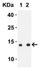 Figure 1 Western Blot Validation with SARS-CoV-2 (COVID-19) ORF8 Protein
Loading: 30 ng per lane of SARS-CoV-2 (COVID-19) ORF8 recombinant protein (10-436) .
Antibodies: SARS-CoV-2 (COVID-19) ORF8, 9289, 1h incubation at RT in 5% NFDM/TBST.
Secondary: Goat anti-rabbit IgG HRP conjugate at 1:10000 dilution.
Lane 1: 1 &#956;g/mL and 
Lane 2: 2 &#956;g/mL