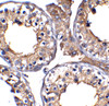 Figure 2 Immunohistochemistry Validation of ACE-2 in COVID-19 Patient Lung 
Immunohistochemical analysis of paraffin-embedded human testis tissue using anti- ACE2 antibody (3217-biotin, 5 ug/mL) . Tissue was fixed with formaldehyde and blocked with 10% serum for 1 h at RT; antigen retrieval was by heat mediation with a citrate buffer (pH6) . Samples were incubated with primary antibody overnight at 4&#730;C, following by streptavidin-HRP conjugate at 20 ug/mL. Counter stained with Hematoxylin.