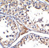 Figure 2 Immunohistochemistry Validation of ACE-2 in COVID-19 Patient Lung 
Immunohistochemical analysis of paraffin-embedded human testis tissue using anti- ACE2 antibody (3217-HRP, 5 ug/mL) . Tissue was fixed with formaldehyde and blocked with 10% serum for 1 h at RT; antigen retrieval was by heat mediation with a citrate buffer (pH6) . Samples were incubated with primary antibody overnight at 4&#730;C.Counter stained with Hematoxylin.
