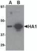 Western blot analysis of (A) 5 ng and (B) 25 ng of recombinant HA1 with Hemagglutinin antibody at 1 &#956;g/mL.
