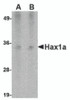 Western blot analysis of Hax1a in human heart tissue lysate with Hax1a antibody at (A) 1 and (B) 2 &#956;g/mL.