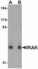 Western blot analysis of IRAK in mouse liver lysate with IRAK antibody at (A) 1 and (B) 2 &#956;g/mL.