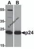 Western blot analysis of 20 ng of (A) viral p24 and (B) recombinant p24 with anti-HIV-1 p24 antibody PM-6585 at (A) 0.5 &#956;g/mL and (B) 0.2 &#956;g/mL, respectively.