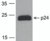 Western blot analysis of 20 ng of HIV-1 p24 protein with PM-6585-biotin at 0.2 &#956;g/mL.