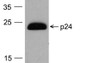 Western blot analysis of 20 ng of HIV-1 p24 protein with PM-6585-HRP at 0.2 &#956;g/mL.