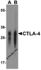 Western blot analysis of CTLA-4 in overexpressing HEK293 cells CTLA-4 antibody at 0.125 and 0.25 &#956;g/mL.