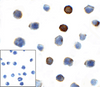 Immunocytochemistry of TIGIT in over expressing HEK293 cells using TIGIT antibody and control mouse IgG antibody (left corner box) at 1 ug/ml.