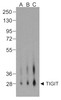 Western blot analysis of TIGIT in over expressing HEK293 cells using RF16054 antibody at (A) 0.25 &#956;g/ml, (B) 0.5 &#956;g/ml, and (C) 1 &#956;g/ml.