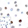 Immunocytochemistry of TIGIT in over expressing HEK293 cells using TIGIT antibody and control mouse IgG antibody (left corner box) at 1 ug/ml.