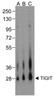 Western blot analysis of TIGIT in over expressing HEK293 cells using RF16056 antibody at (A) 0.25 &#956;g/ml, (B) 0.5 &#956;g/ml, and (C) 1 &#956;g/ml.