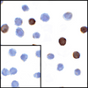 Immunocytochemistry of LIGHT in transfected HEK293 cells with LIGHT antibody at 1 ug/mL. Lower left: Immunocytochemistry in transfected HEK293 cells with control mouse IgG antibody at 1 ug/mL.