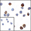 Immunocytochemistry of VISTA in transfected HEK293 cells with VISTA antibody at 1 ug/mL. Lower left: Immunocytochemistry in transfected HEK293 cells with control mouse IgG antibody at 1 ug/mL.