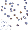 Immunocytochemistry of LAG-3 in over expressing HEK293 cells using LAG-3 antibody and control mouse IgG antibody (left corner box) at 1 ug/ml.