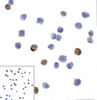 Immunocytochemistry of LAG-3 in over expressing HEK293 cells using LAG-3 antibody and control mouse IgG antibody (left corner box) at 1 ug/ml.