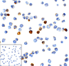 Immunocytochemistry of TIM-3 in transfected HEK293 cells with TIM-3 antibody at 1 ug/mL. Lower left: Immunocytochemistry in transfected HEK293 cells with control mouse IgG antibody at 1 ug/mL.