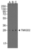 Western blot analysis of TMIGD2 in overexpressing HEK293 cells TMIGD2 antibody at 0.25, 0.5, and 1 &#956;g/ml