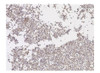 SARS-CoV-2 Spike RBD Antibody (clone 2165) IHC Data using infected cell pellets.