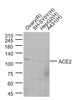<strong>Figure 1 Western Blot Validation of ACE2</strong><br>
Lane 1: rat ovary lysates, Lane 2: SH-SY5Y cell lysates, Lane 3: HepG2 cell lysates, Lane 4: A431 cell lysates probed with ACE2 antibody, 10-600, at 1:1000 dilution and 4˚C overnight incubation. Followed by conjugated secondary antibody incubation at 1:20000 for 60 min at 37˚C.