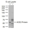 <strong>Figure 2 Western Blot Validation of ACE2</strong><br>
Lane 1: ACE2 protein overexpression E.coli lysates and Lane 2: control group E.coli lysates probed with ACE2 antibody, 10-600, at 1:1000 dilution and 4˚C overnight incubation. Followed by conjugated secondary antibody incubation at 1:20000 for 60 min at 37˚C.