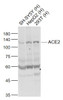 <strong>Figure 1 Western Blot Validation of ACE2</strong><br>
Lane 1: SH-SY5Y cell lysates, Lane 2: HepG2 cell lysates and Lane 3: 293T cell lysates probed with ACE2 antibody, 10-602, at 1:1000 dilution and 4˚C overnight incubation. Followed by conjugated secondary antibody incubation at 1:20000 for 60 min at 37˚C.