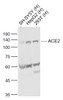 <strong>Figure 1 Western Blot Validation of ACE2</strong><br>
Lane 1: SH-SY5Y cell lysates, Lane 2: HepG2 cell lysates and Lane 3: 293T cell lysates probed with ACE2 antibody, 10-603, at 1:1000 dilution and 4˚C overnight incubation. Followed by conjugated secondary antibody incubation at 1:20000 for 60 min at 37˚C.