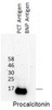 Antibody: 54-301 at 1/1000 dilution<br>Sample: 30 ng recombinant procalcitonin<br>Secondary: HRP conjuggated anti-Rabbit Fc at 1/50000 dilution<br>Predicted band size: 17 kDa<br>Observed band size: 17 kDa<br>Gel concentration: 4-20%