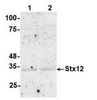 Antibody: 54-335 at 1/1000 dilution<br>Sample: Lane: 1 3 ug mouse brain tissue lysate. Lane: 2 10 ug mouse brain tissue lysate<br>Secondary: HRP-conjugated anti-rabbit IgG at 1/50000 dilution<br>Predicted band size: 31 kDa<br>Observed band size: 33 kDa<br>Gel concentration: 4-20%