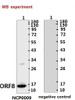 <strong>Figure 1 Western Blot Validation with Recombinant Protein</strong><br>Loading: 1ug of recombinant protein per lane. Antibodies: SARS-CoV-2 (COVID-19) ORF8 Antibody (IN) , 10-511, 1:500. Secondary: Goat anti-rabbit IgG HRP conjugate at 1:20000 dilution.