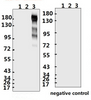 <strong>Figure 1 Western Blot Validation with Recombinant Protein</strong><br>Loading: 1ug of recombinant protein ¬ per lane. Lane 1: 10-007, Lane 2: 10-008 and Lane 3: 10-011. Antibodies: SARS-CoV-2 (COVID-19) Spike S1, 10-524, 1:500. Secondary: Goat anti-rabbit IgG HRP conjugate at 1:20000 dilution.