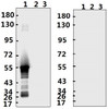 <strong>Figure 1 Western Blot Validation with Recombinant Protein</strong><br>Loading: 1ug of recombinant protein per lane. Lane 1: 10-007, Lane 2: 10-008 and Lane 3: 10-011. Antibodies: SARS-CoV-2 (COVID-19) Nucleocapsid, 10-530, 1:500. Secondary: Goat anti-rabbit IgG HRP conjugate at 1:20000 dilution.