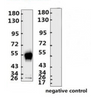 <strong>Figure 1 Western Blot Validation with Recombinant Protein</strong><br>Loading: 1ug of SARS-CoV-2 (COVID-19) nucleocapsid recombinant protein, 10-007, per lane. Antibodies: SARS-CoV-2 (COVID-19) Nucleocapsid Monoclonal Antibody, 10-546, 1:2000. Secondary: Goat anti-human IgG HRP conjugate at 1:5000 dilution.