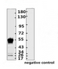 <strong>Figure 1 Western Blot Validation with Recombinant Protein</strong><br>Loading: 1ug of SARS-CoV-2 (COVID-19) nucleocapsid recombinant protein, 10-007, per lane. Antibodies: SARS-CoV-2 (COVID-19) Nucleocapsid Monoclonal Antibody, 10-547, 1:2000. Secondary: Goat anti-human IgG HRP conjugate at 1:5000 dilution.