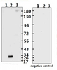 <strong>Figure 1 Western Blot Validation with Recombinant Protein</strong><br>Loading: 1ug of recombinant protein per lane. Lane 1: 10-007, Lane 2: 10-008 and Lane 3: 10-011. Antibodies: SARS-CoV-2 (COVID-19) Spike-ECD/RBD Monoclonal, 10-555, 1:500. Secondary: Goat anti-human IgG HRP conjugate at 1:5000 dilution.