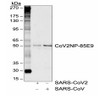 Western blot analysis of SARS-CoV2 and SARS-CoV nucleocapsid protein (50 ng) probed with 1 ug/mL CoV2NP rabbit monoclonal antibody (85E9) , CoV2NP-85E9.
