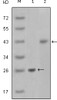 Western blot analysis using AMACR monoclonal antibody against truncated AMACR - His recombinant protein and Jurkat cell lysate.