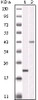 Western blot analysis using AURKB monoclonal antibody against truncated AURKB recombinant protein and SKN - SH cell lysate.