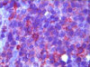 Immunohistochemical analysis of paraffin - embedded human lymph tissue showing membrane localization using CD10 antibody AEC staining.