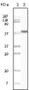 Western blot analysis using CK1 monoclonal antibody against truncated CK1 recombinant protein.