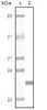 Western blot analysis using Desmin monoclonal antibody against truncated Desmin recombinant protein